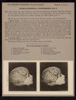 Cranio-Cerebral Topography - no. 5